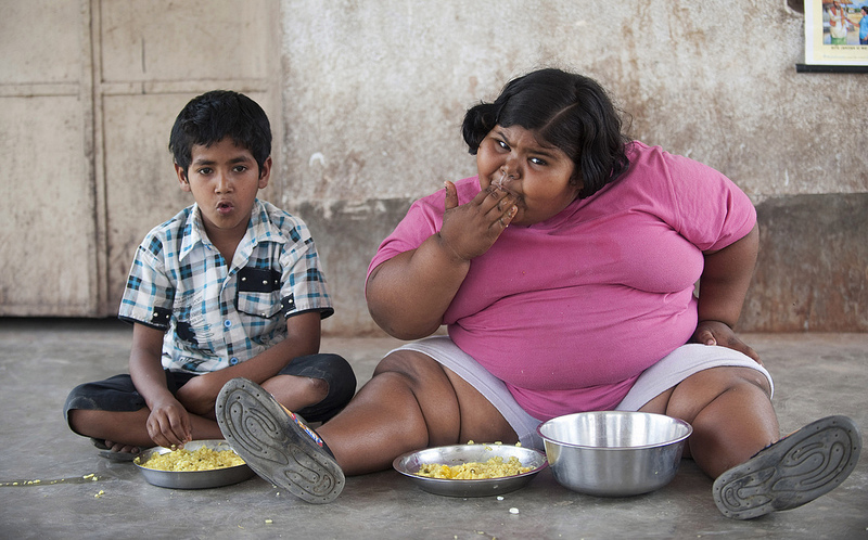 Дети, страдающие ожирением, имеют проблемы с печенью и гипертонией