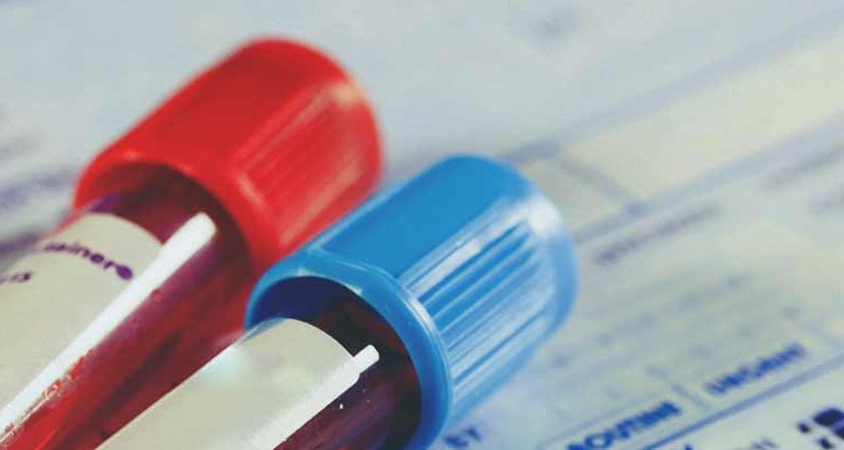 Ovogenesis yumurta oluşumu sürecidir. Spermatogenez ve oogenez 17