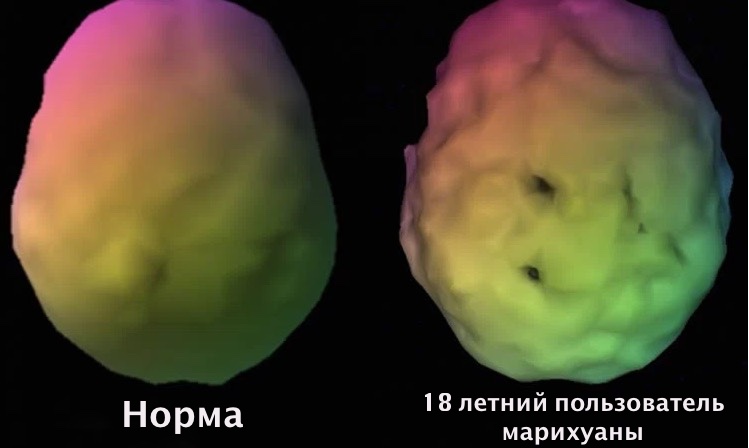 марихуана, болезнь Альцгеймера
