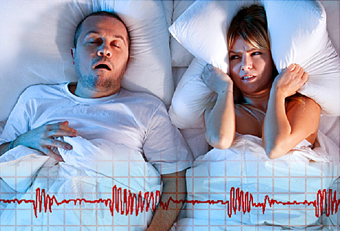 апноэ сна, сердечно-сосудистые заболевания