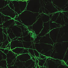 макрофаги, нервные клетки