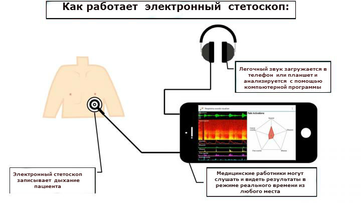 Электронный стетоскоп схема