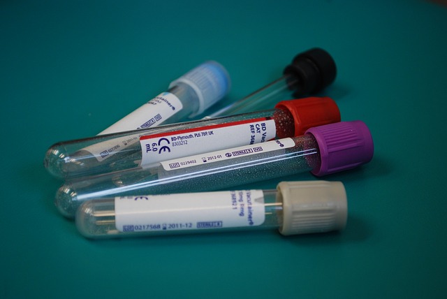 анализ крови, эозинофилия