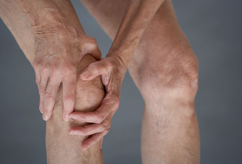 артроз, коленный сустав