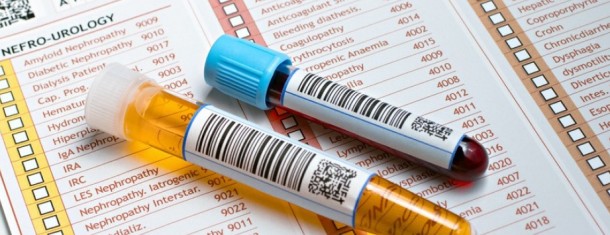 Инфекции мочевыводящих путей, лейкоциты, моча, мочеиспускание