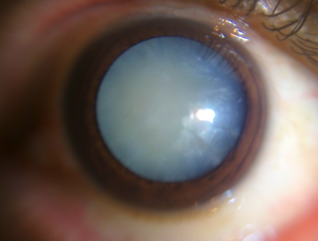 Связь болезней суставов и болезней глаз thumbnail