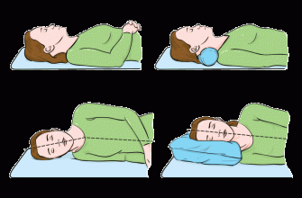 Как правильно спать чтобы не болела. Позы для сна чтобы не болела шея. Как правильно спать чтобы не болела шея. Болит спина и шея после сна. Болит шея лежа на подушке.