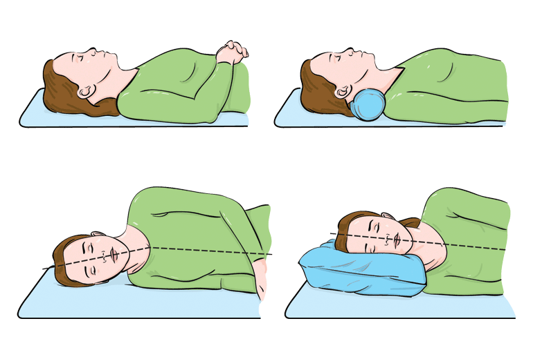 Почему нужна подушка. Положение головы на подушке. Спать на спине. Правильное лежание на подушке. Правильное положение для сна.