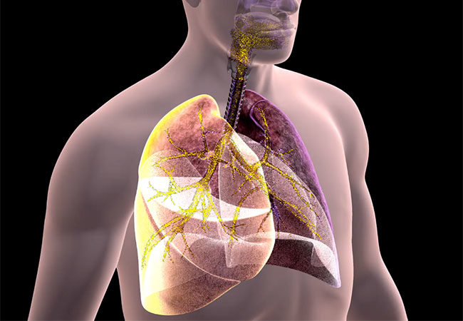 Лечение астмы народными средствами в домашних условиях thumbnail